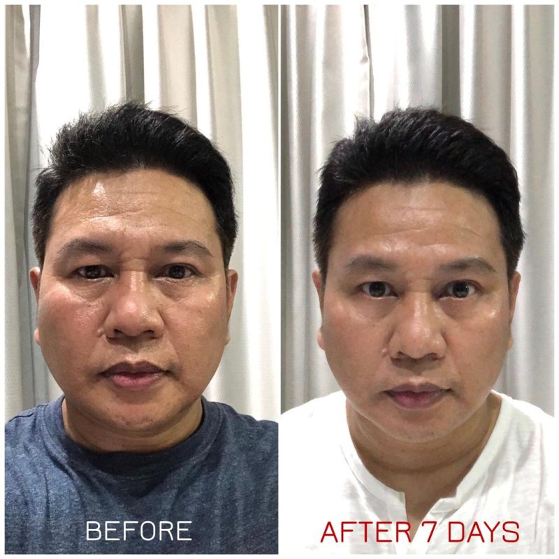 Serum Nano Pencerah MIRAC Tampilkan Cahaya di Setiap Tetes - Image 9