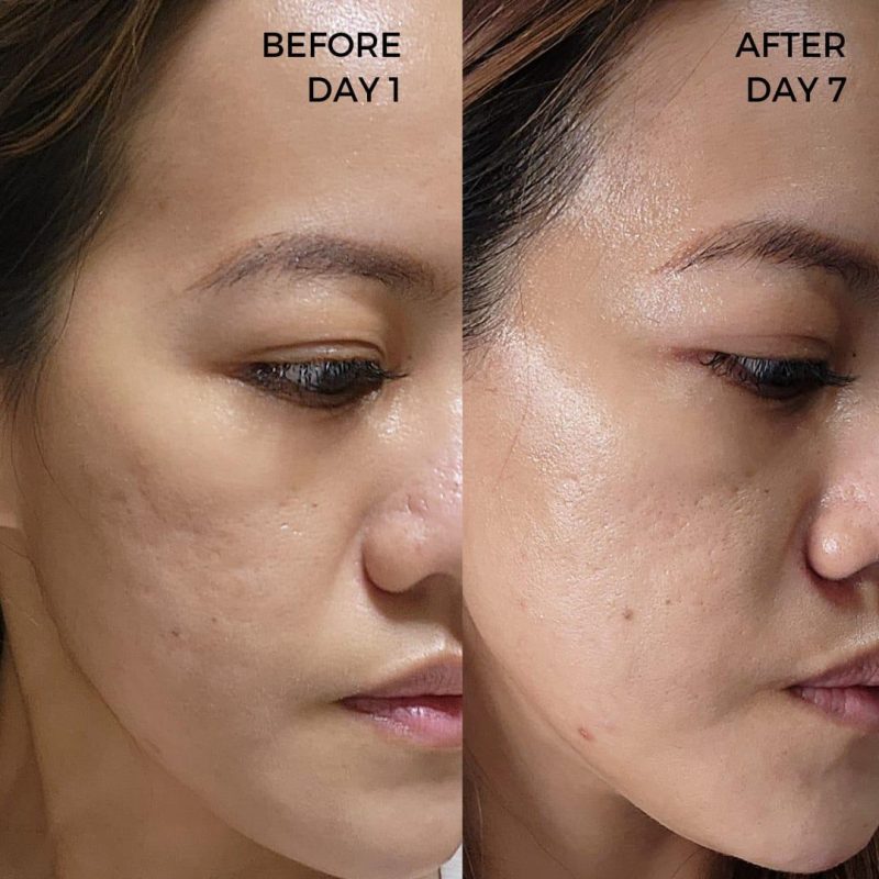 Serum Nano Pencerah MIRAC Tampilkan Cahaya di Setiap Tetes - Image 11