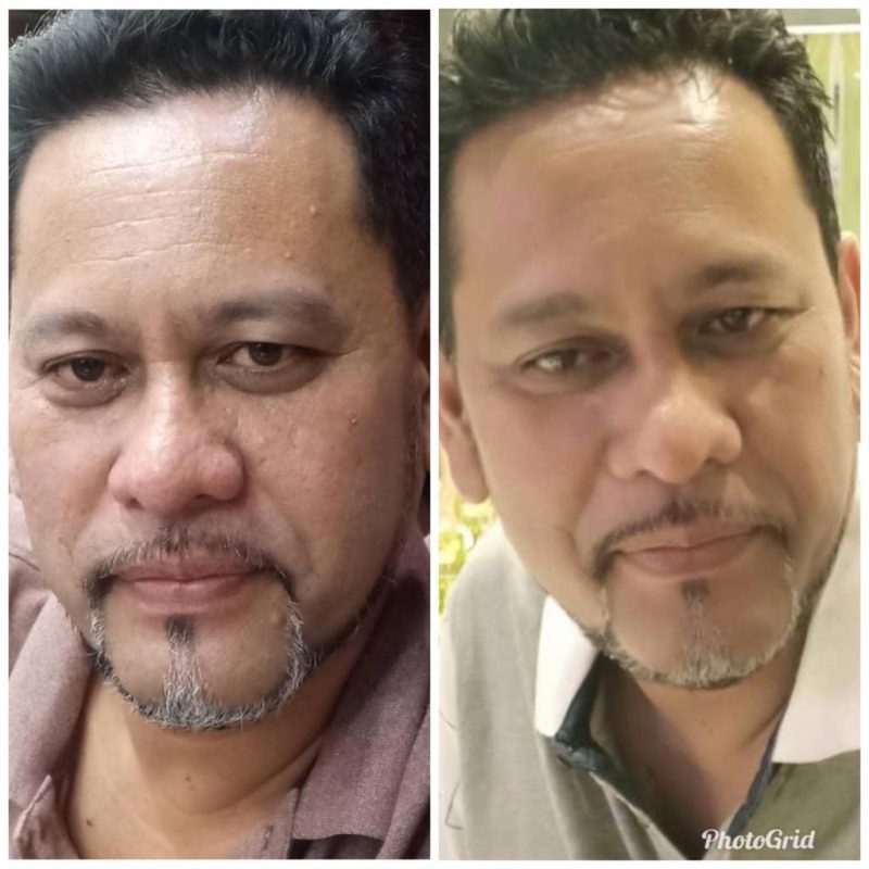Serum Nano Pencerah MIRAC Tampilkan Cahaya di Setiap Tetes - Image 12